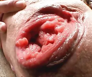 enorme y anormales propagación pussy